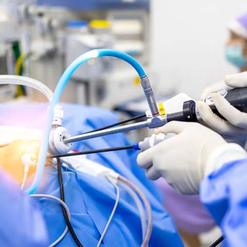 Behandlung der Schulterinstabilität nach Auskugeln - Orthopädie in Düsseldorf