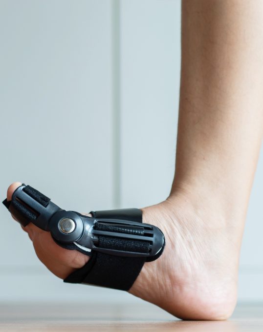 Behandlung bei Hallux rigidus - Orthopädie in Düsseldorf