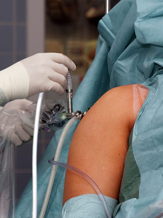 Arthroskopische Behandlung (Gelenkspiegelung) - Orthopädie in Düsseldorf
