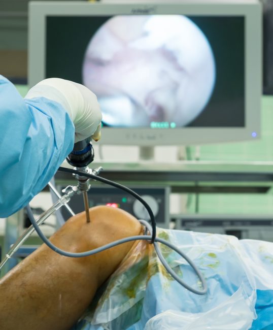 Die Behandlung bei einem Meniskusriss - Orthopädie in Düsseldorf