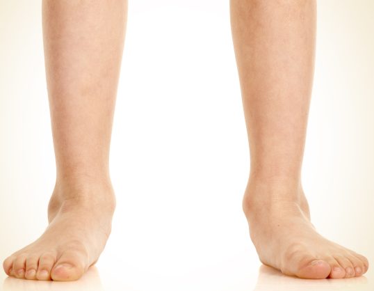 Symptome von Krallen- oder Hammerzehen - Orthopädie in Düsseldorf