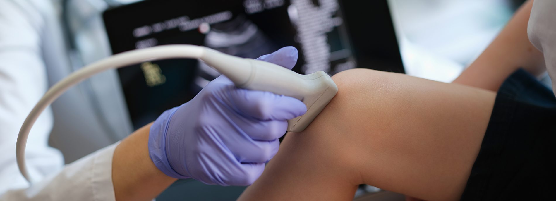 Effektive Behandlung von Meniskusrissen in Düsseldorf